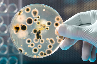 NIV has three units located at Gorakhpur, Kerala and Bangalore. The unit at Bangalore has a polio-monitoring center. 