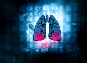 Siemens has also launched a unique mobile imaging solution for lung cancer screening