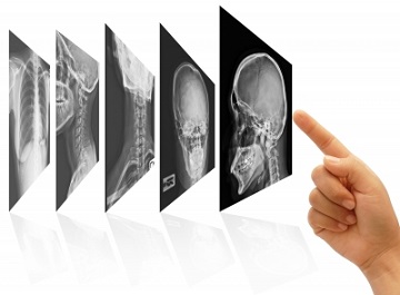 The new Digital Radiography technology is superior, cost effective and much healthier 